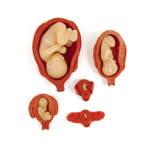 자궁내태아모형세트 자궁내태아모형 태아모형 태아인형 [27007]