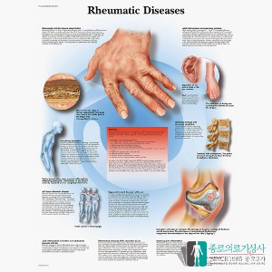 3B Scientific 류마티스 인체해부차트 VR1124 Rheumatic Diseases 병원액자