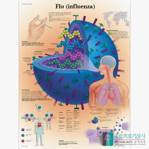3B Scientific 유행성 감기 Flu 인체해부차트 VR1722 Influenza 병원액자