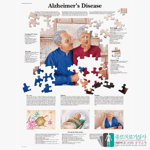 3B Scientific 알츠하이머의 이해 인체해부차트 VR1628 치매 병원액자