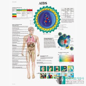 3B Scientific 에이즈의 이해 인체해부차트 VR1727 AIDS 병원액자