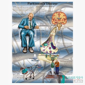 3B Scientific 파킨슨병의 이해 인체해부차트 VR1629 Parkinson 병원액자