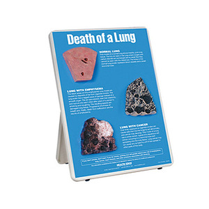 폐의 운명 Death of a Lung [79148]