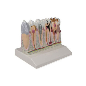 치아 단면 모형 (4배 크기) (D250)