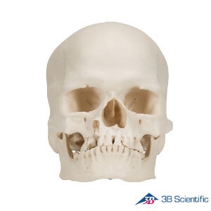 3B Scientific 인체모형 소두증 두개골모형 A29/1 BONElike 2분리