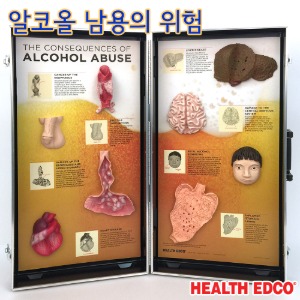 HEALTH EDCO USA 78879 알코올남용의결과 음주교육 음주예방교육