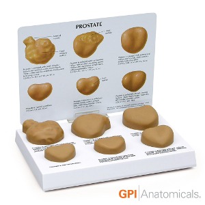 GPI USA 인체해부모형 G300 실제사이즈 비뇨기과모형 전립선해부모형