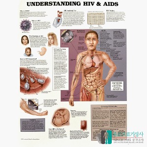 인체해부도 3D차트 병원액자 9760 HIV AIDS 에이즈의 이해 54X74cm 액자옵션