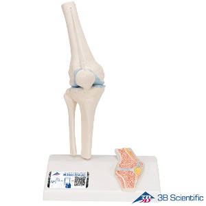 3B Scientific 무릎관절모형 1/2 미니사이즈 단면포함 A85/1 Knee Joint 관절모형