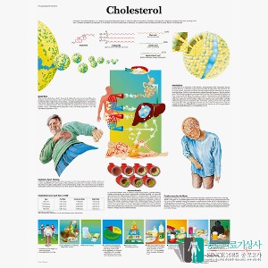 3B Scientific 콜레스테롤 인체해부차트 VR1452 Cholesterol 병원액자