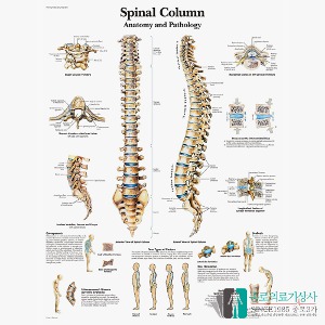 3B Scientific 척추차트 VR1152 Spinal Column 척추질병 병원액자